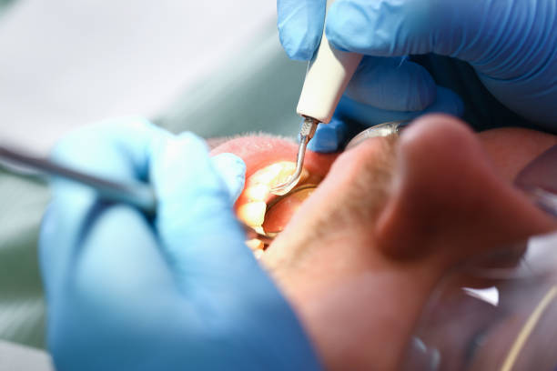 Best Emergency Dental Services for Seniors in Higganum, CT